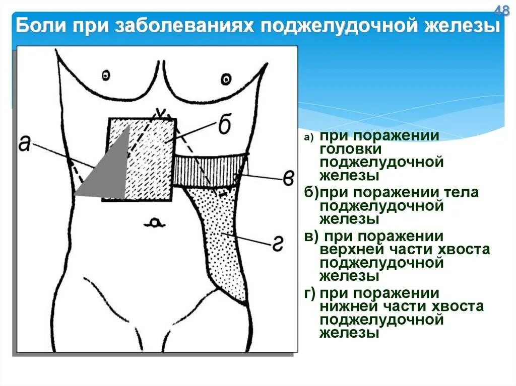 Поджелудочная боль в спине. Боль в поджелудочной железе. Локализация боли в поджелудочной железе. Панкреатит локализация боли. Боли в животе поджелудочная железа.