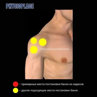 Схема Точек Для Хиджамы