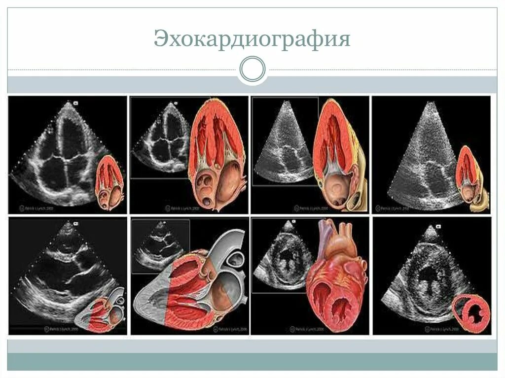 УЗИ сердца (допплерэхокардиография). Эхокардиография Эхо кг УЗИ сердца. 4) Эхокардиография. Эхокардиография Эхо кг сердца что это. Эхо кс цена