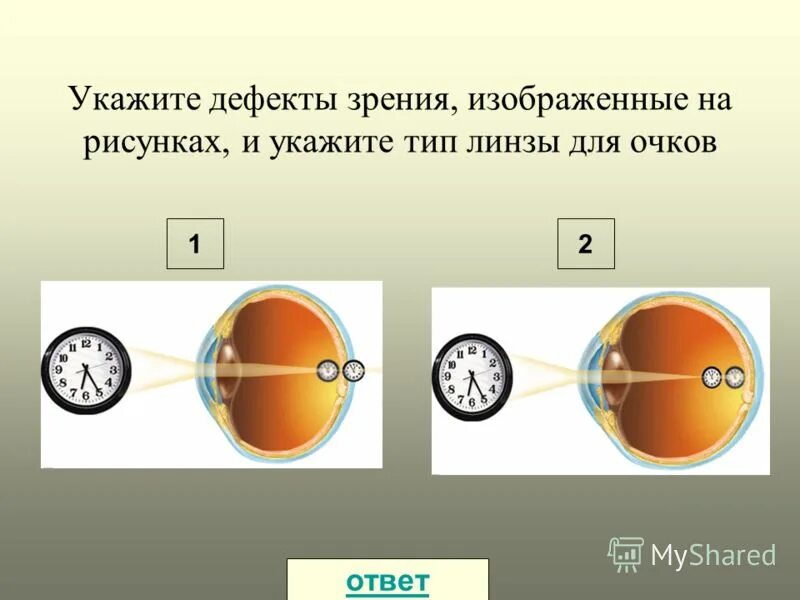 Глаз дефекты зрения презентация. Глаз дефекты зрения презентация. Глаз как оптическая система дефекты зрения. Глаз дефекты зрения презентация. Глаз дефекты зрения презентация.