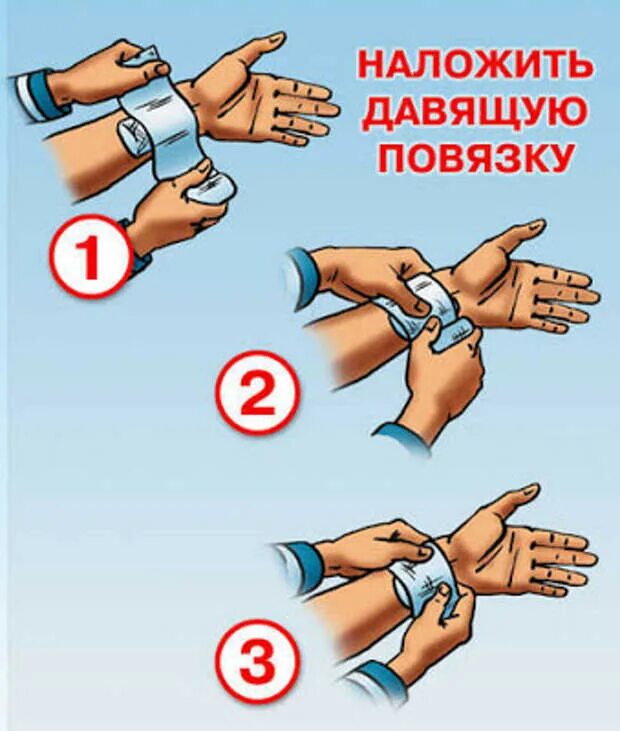 Венозное кровотечение предплечья первая помощь