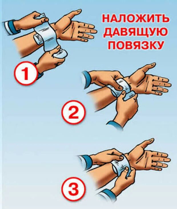 Давящая повязка при кровотечении время. Оказание первой помощи при кровотечении из вены. Оказание первой медицинской помощи при венозном кровотечении. Венозное кровотечение первая помощь кратко. Как оказать первую помощь при венозном кровотечении.