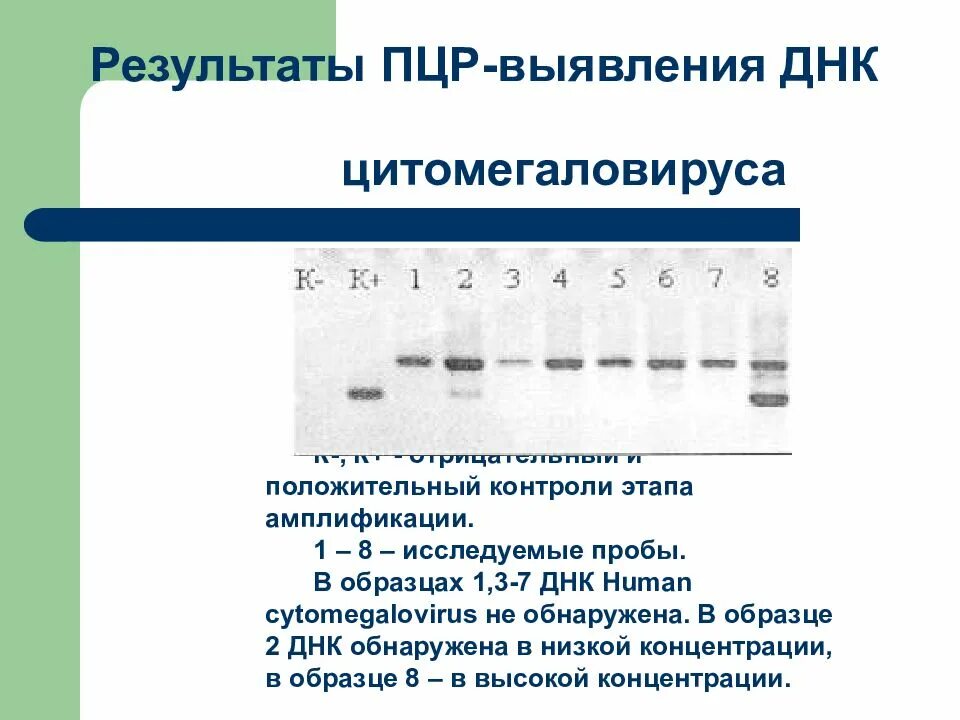 Действие с положительными тестами. Положительный ПЦР. Результат ПЦР. Результат реакции ПЦР. Результат ПЦР теста.