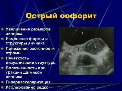 Болит яичник слева. Болит яичник слева