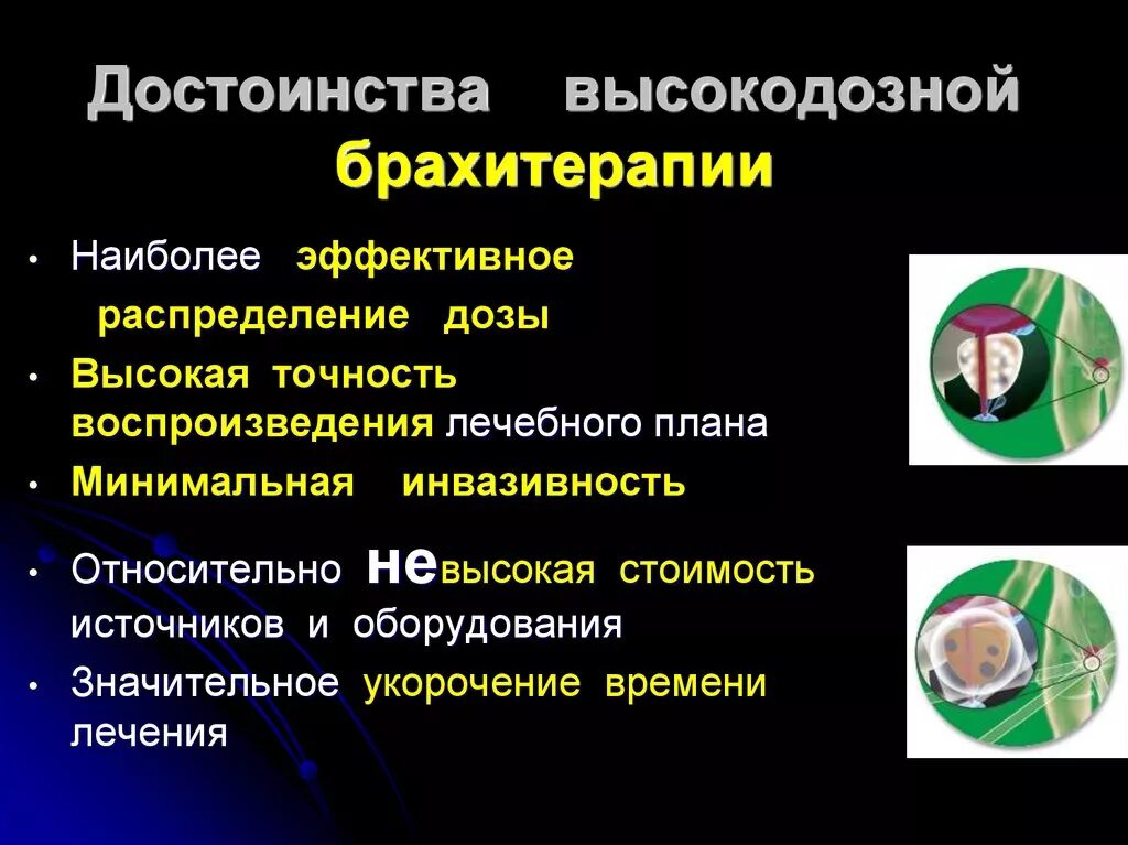 Показания для брахитерапии. Высокодозная брахитерапия. Высокодозная брахитерапия предстательной железы. Процедура высокодозной брахитерапии. Брахитерапия простаты цена