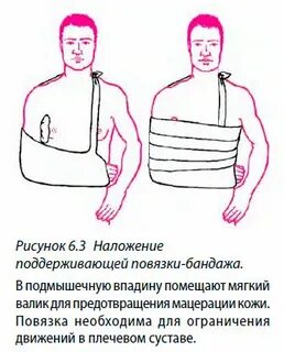 Повязка вельпо алгоритм