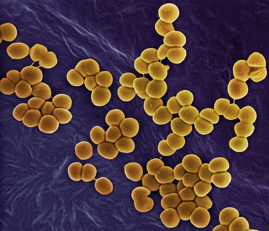 Врачи золотистый стафилококк. Staphylococcus aureus царство. S. aureus золотистый стафилококк. Антигены стафилококка ауреус.