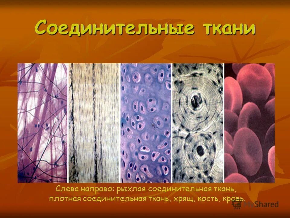Соединительная ткань хрящ. Соединительная ткани хрящевая биология. Соединительная ткань 7 класс биология. Рыхлая ткань растений.