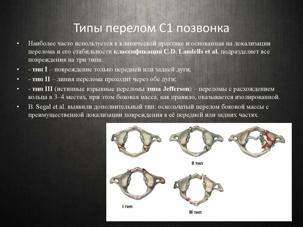 Два типа перелома