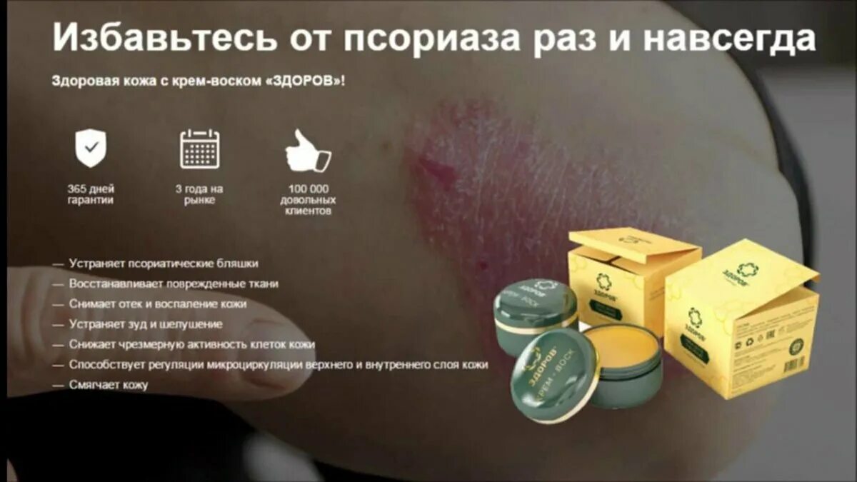 Народные средства от псориаза. Как вылечить псориаз раз и навсегда. Как вылечить псориаз раз и навсегда. Быстро избавиться от псориаза. Народные средства от псориаза.