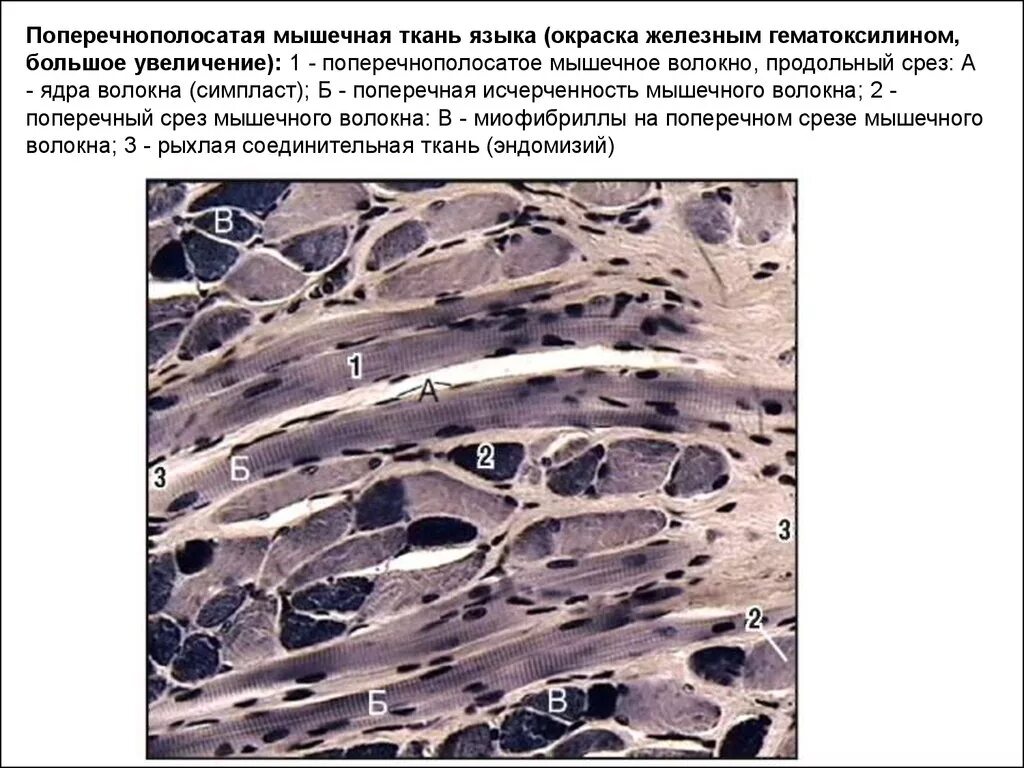 Поперечнополосатая Скелетная мышечная гистология. Поперечно полосатая мышечная ткань Железный гематоксилин. Поперечнополосатая мышца гистология. Скелетная мышечная ткань гистология. Препарат поперечно полосатая мышечная ткань