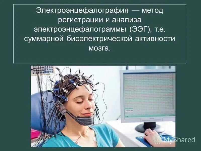 Записаться на ээг. Энцефалограмма головного мозга. Электроэнцефалографическое исследование (ЭЭГ. Метод электроэнцефалографии. ЭЭГ методика проведения.