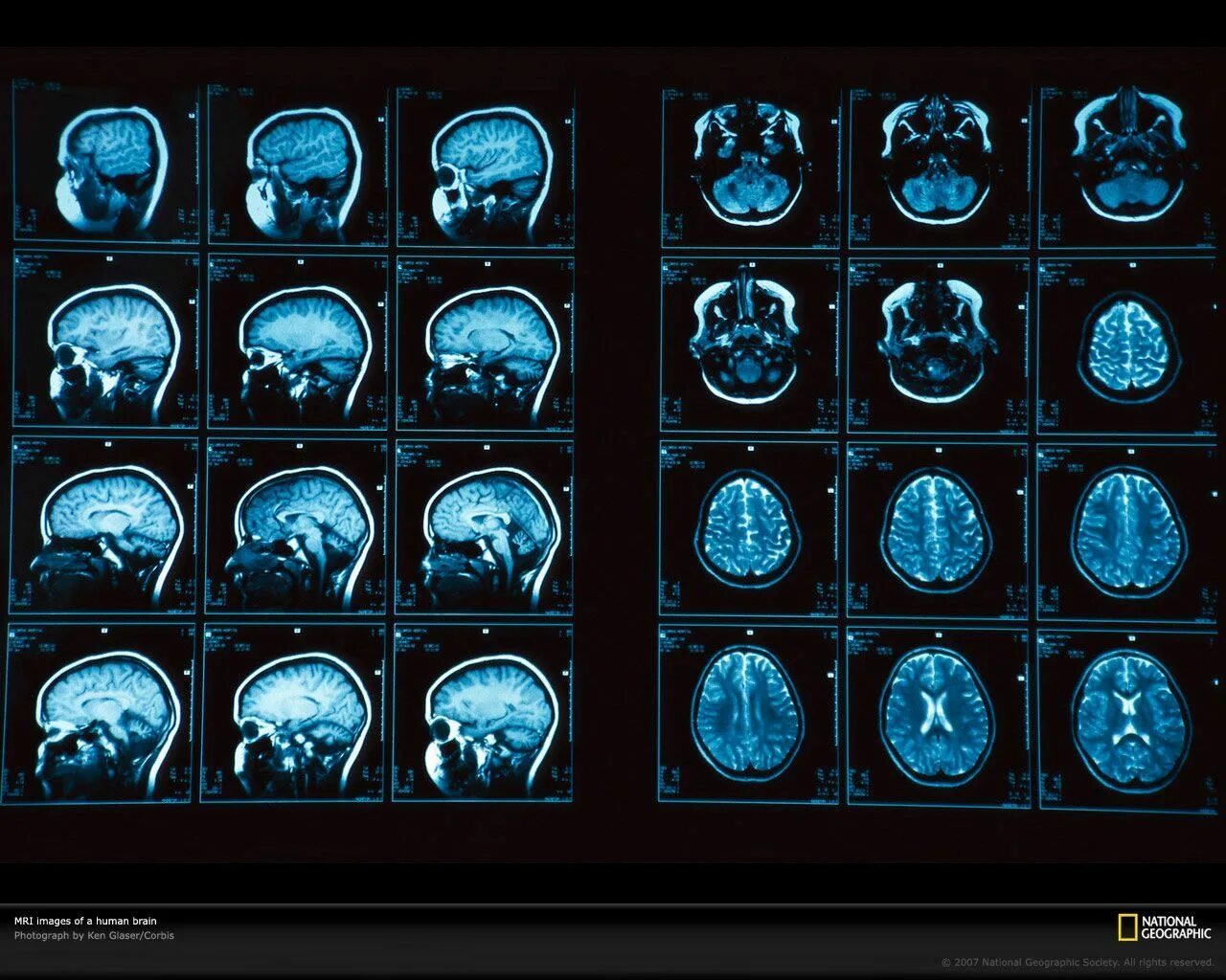 Brain цены. Кт томограмма головного мозга. Магнитно-резонансная томография мрт снимки. Компьютерная томография кт головного мозга. Магнито-резонансная томография головного мозга.