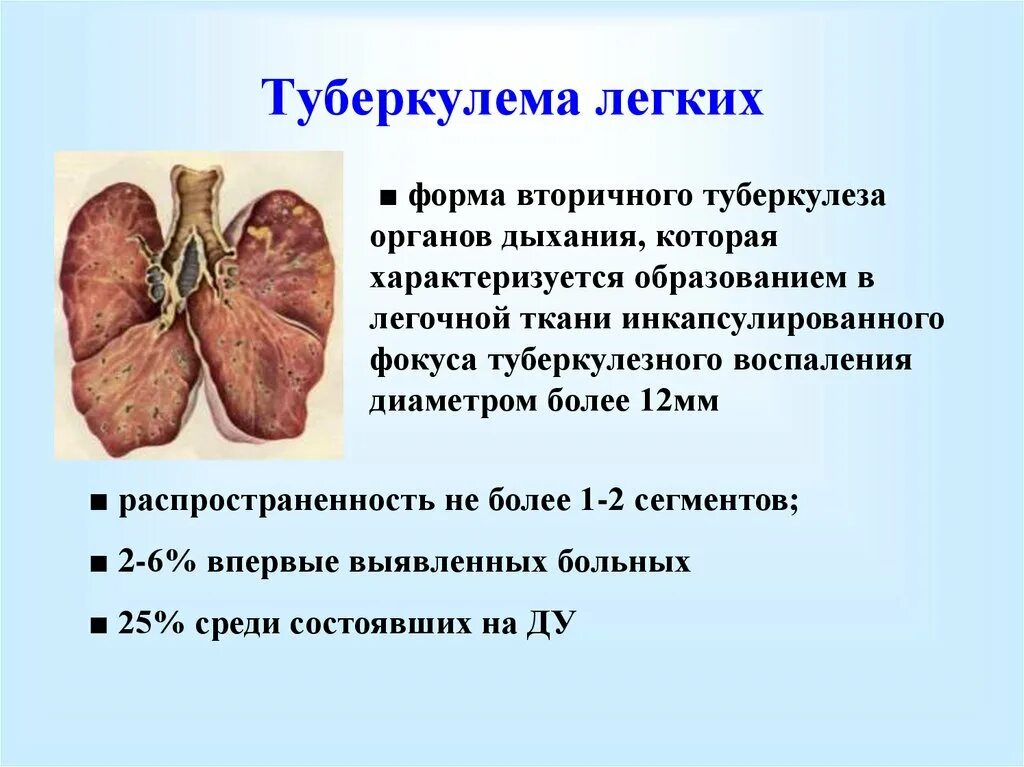 Купирование легких. Туберкулема фтизиатрия. Туберкулема легкого презентация. Туберкулема легких фтизиатрия.