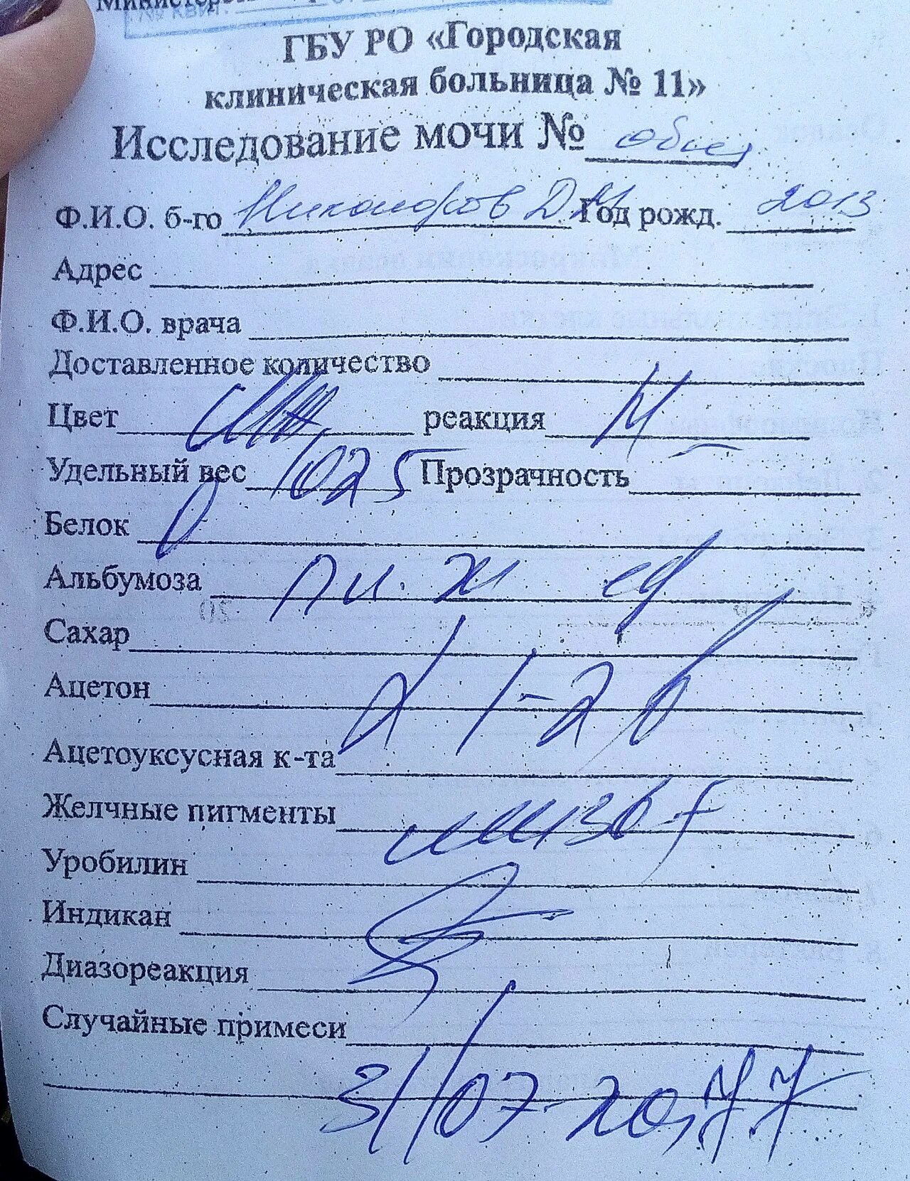 Анализ мочи. Исследование ацетона в моче. Общий анализ мочи. Общий анализ мочи желчные пигменты.