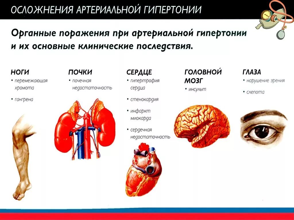 Осложнени ягипертогнической болезни. Осложнения гипертонической болезни. Осложнения заболевания гипертонической болезни. Осложнения сердца при гипертонической болезни. Артериальное давление осложнения