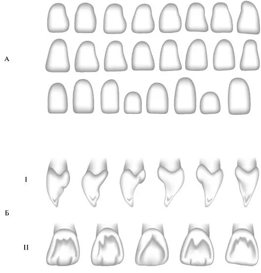 Зубы анатомия резцы клыки. Форма коронок зубов верхней челюсти. Формы резцов зубы. Формы резцов зубы. Центральный резец верхней челюсти моделирование.