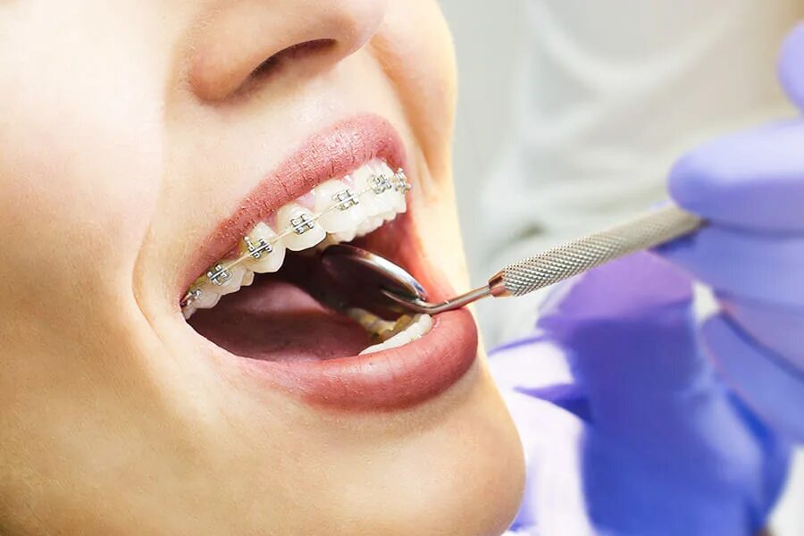 Ортодонтия. Стоматолог ортодонт. Баннер ортодонт. На приеме у ортодонта.