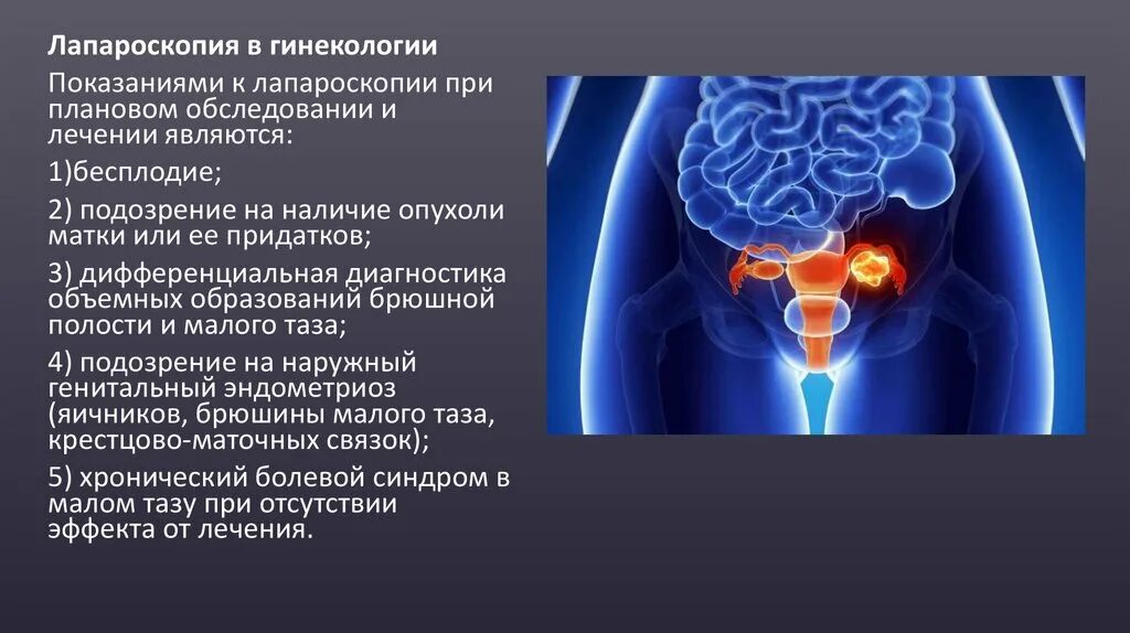 Лапароскопия показания. Лапароскопия в гинекологии показания. Показания к плановой лапароскопии. Показаниями к проведению лапароскопии являются. Лапароскопия показания в акушерстве.