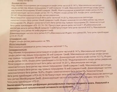 Срединно стволовые структуры