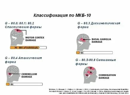 Тетрапарез код по мкб. Тетрапарез код по мкб