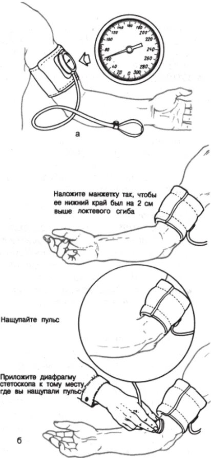 Алгоритм измерения артериального давления Сестринское дело. Техника измерения давления алгоритм. Измерение артериального давления алгоритм. Измерение артериального давления алгоритм манипуляции.