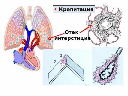Интерстиций это орган