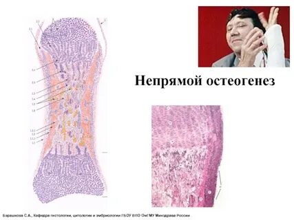 Перихондральное окостенение при непрямом остеогенезе