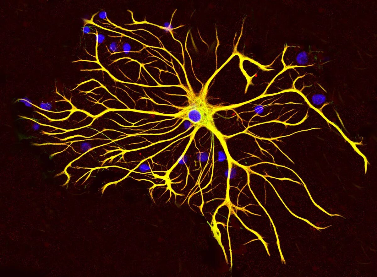 Клетки мозга человека состоят из. Нервные клетки и глиальные клетки. Астроциты глиальный. Нервная клетка и глия. Нервная ткань Нейроны и глиальные клетки.