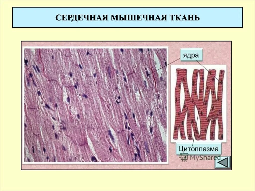 Сердечно полосатая мышца. Поперечно-полосатая сердечная мышечная ткань. поперечнополосатая мышечная ткань гистология. поперечнополосатая сердечная мышечная ткань гистология препарат. поперечнополосатая сердечная мышечная ткань рисунок.