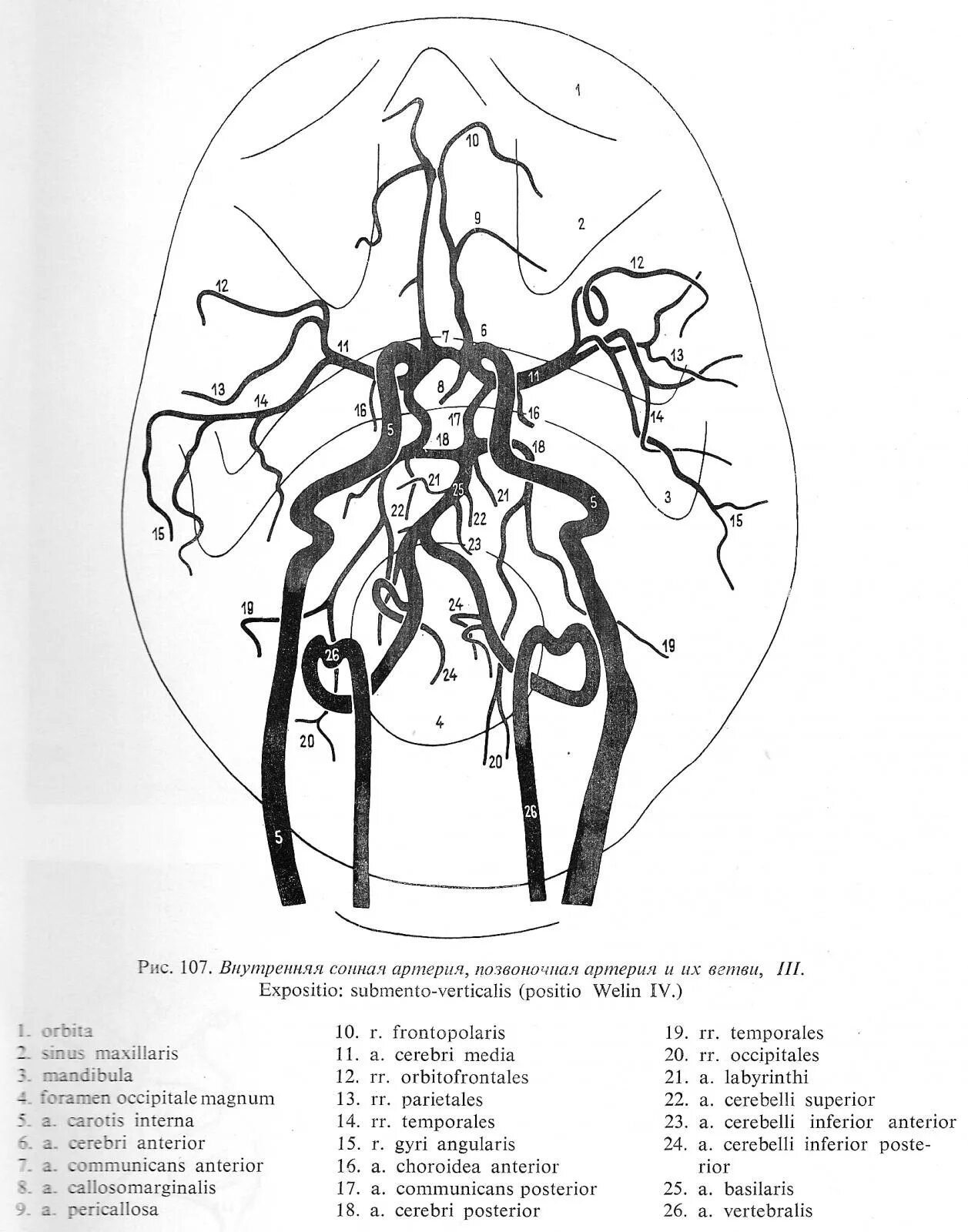 Виллизиев круг сосуды. Сегменты средней мозговой артерии на кт. Внутренняя Сонная артерия анатомия кт. Сосуды виллизиевого круга мрт. Сегменты средней мозговой артерии схема мрт.
