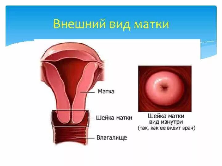 Псевдоэрозия шейки матки виды. Нормальная лейка матки. Матка эрозия шейки матки. Цервикальный канал размеры