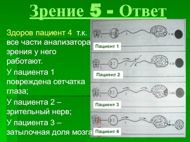 Что такое зрение 1 5. Зрение -5. зрение -5.5. как выглядит зрение -6. зрение минус 1.5.