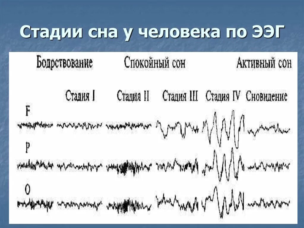 Стадии сна. Фазы сна. Фазы сна человека ЭЭГ. ЭЭГ сна.