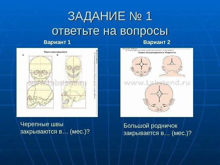 Большой родничок сроки. Измерение большого родничка. Измерение большого родничка у ребенка. Большой Родничок Размеры по месяцам. Размеры большого родничка.