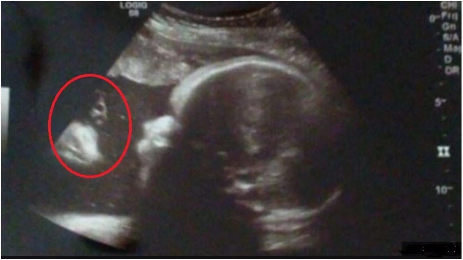 34 недели беременности фото. 26 Неделя беременности УЗИ мальчик.
