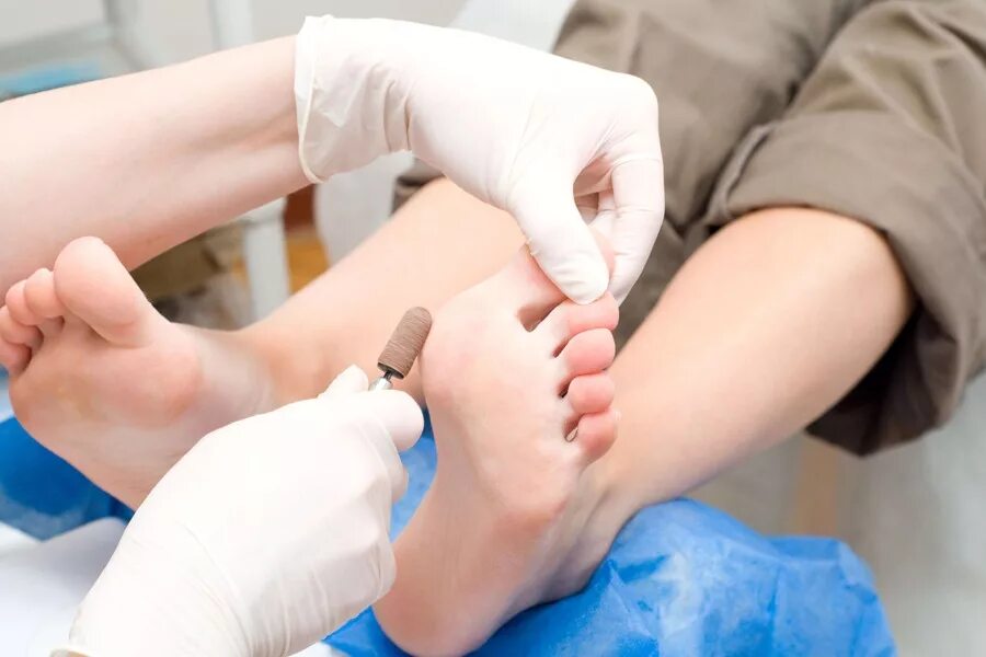 обработка стоп ног