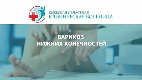 Варикоза нет нижний новгород