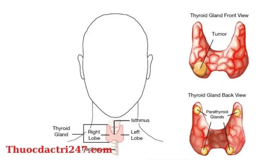 Щитовидная железа узлы в правой доле. Киста щитовидной железы. Узлы и кисты щитовидной железы. Щитовидная железа рисунок. Кистозные узлы в щитовидной железе.