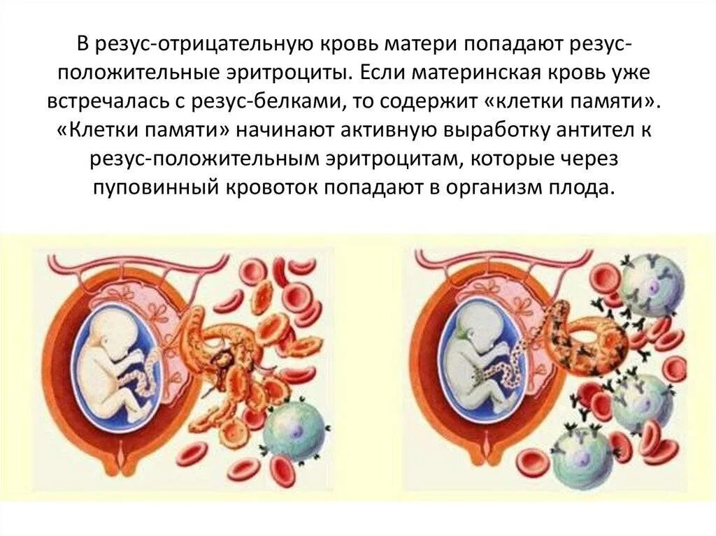 1 отрицательная группа крови беременность