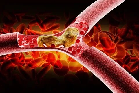 Cholesterol
