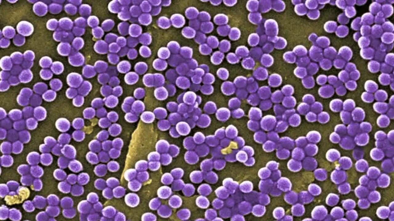 Стафилококк ауреус под микроскопом. Золотистый стафилококк микроскопия. Staphylococcus epidermidis под микроскопом. Staphylococcus saprophyticus под микроскопом.