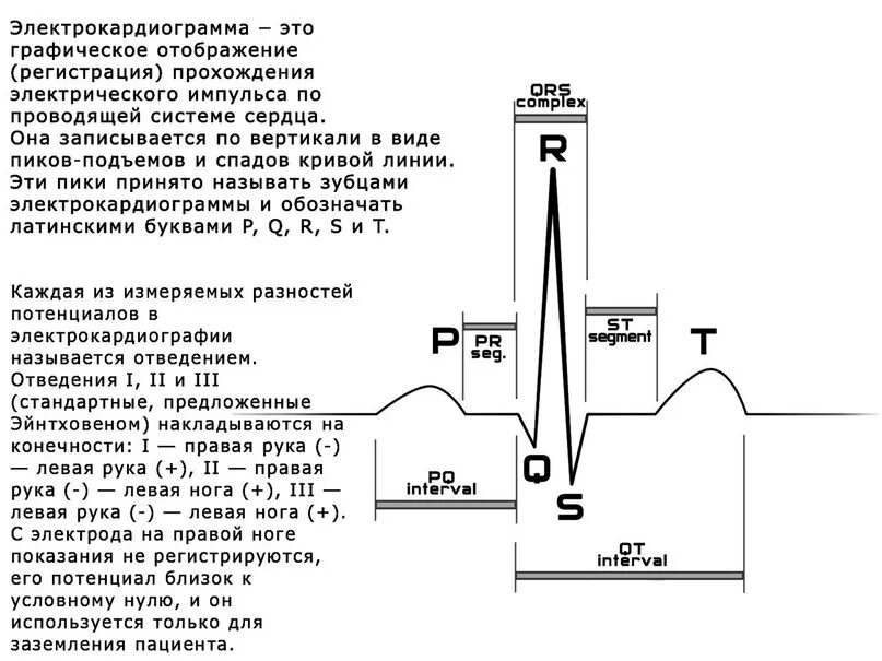 ЭКГ сердца с расшифровкой зубцы. ЭКГ схема зубцы. Схема чтения ЭКГ. Схема скорости зубцов ЭКГ.