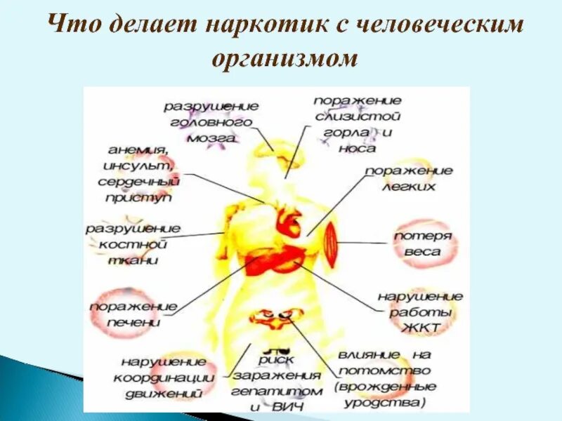 На какие системы влияют наркотики. Воздействие наркотиков на организм человека. Влияние наркотиков на внутренние органы. Влияние наркомании на организм человека.