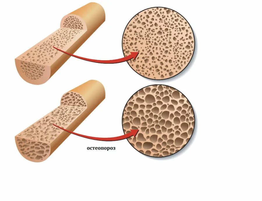 Bone mineral