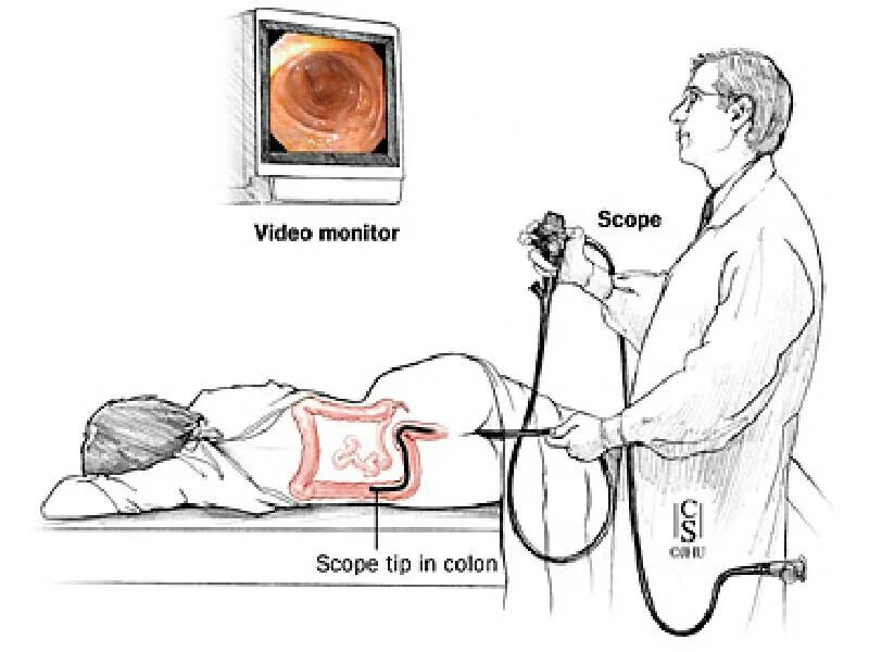 Эндоскопическое исследование толстой кишки колоноскопия. Колоноскопия кишечника аппарат. Эндоскопическое исследование прямой кишки называется. Колоноскопия это исследование Толстого кишечника. Подготовка пациента к ректороманоскопии колоноскопии