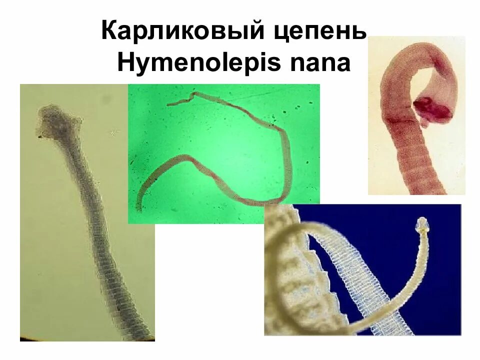 Карликовый цепень (Hymenolepis Nana). Класс ленточные черви карликовый цепень. Ленточные черви паразиты карликовый цепень. Гименолепидоз карликовый цепень.