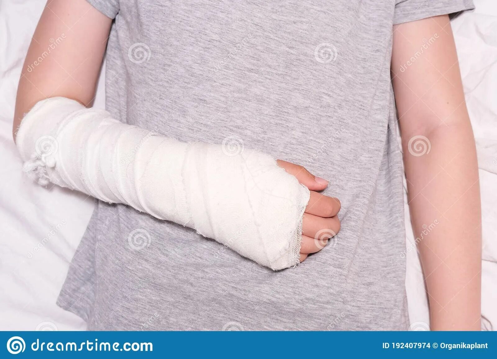 Hand blocks in medicine. Картинка связанная с переломами. Ребенок со сломанной рукой фото. Отпуск сломана рука. Циркулярная гипсовая повязка на руку.