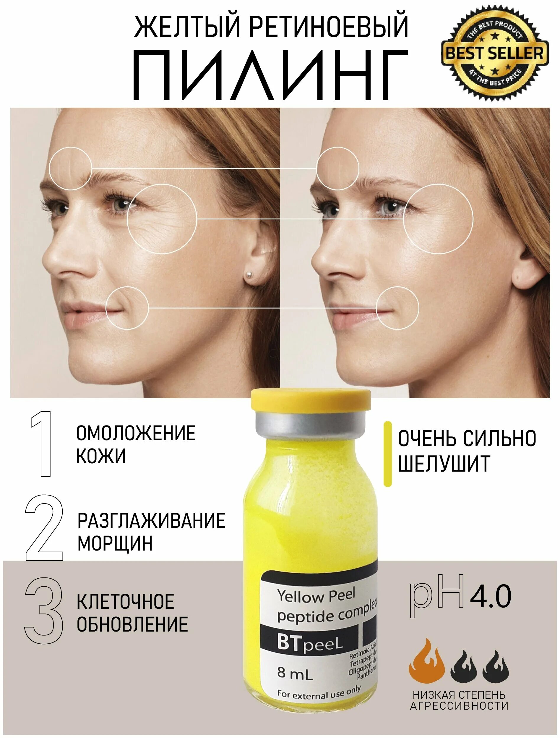 желтый пилинг btpeel. желтый пилинг btpeel. желтый пилинг btpeel. Yellow peel желтый. Yellow peel желтый.