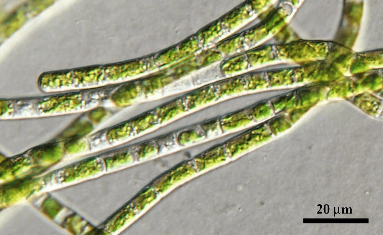 Klebsormidium flaccidum. Драпарнальдия водоросль. Кладофора водоросль микроскоп. Нитчатые водоросли под микроскопом.